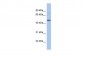 CBX8 antibody - N-terminal region