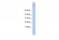 TSC22D1 antibody - middle region