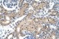 CHRNB2 antibody - middle region