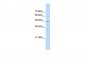 CHRNB2 antibody - middle region
