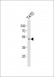 HOXA10 Antibody (Center)