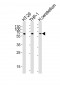 CF150 Antibody  (Center)