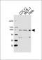 HSP90B1 Antibody (Center)