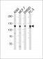 GAA Antibody (N-term)