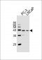 VDR Antibody (Center)