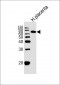 Alkaline Phosphatase (ALPI) Antibody (Center)