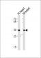ASB11 Antibody (N-term)