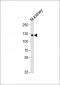 Mouse Ddr1 Antibody (Center)