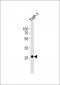 NDUFS3 Antibody (C-term)