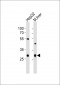 CTDSP1 Antibody (N-term)