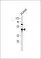 SERPINE1 Antibody (C-term)