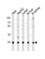 UBB(Ubiquitin) Antibody (N-term)