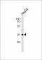 ABT1 Antibody (C-term)