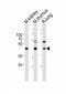 (Mouse) Dlk1 Antibody (C-term)