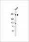 DNMT1 Antibody (N-term)