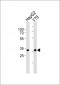 OTX2 Antibody (C-term)