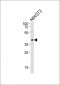 CBX8 Antibody (C-term)