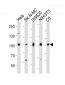 CTNNB1 Antibody (C-term)