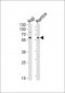 LYN Antibody (N-term)