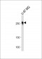 ROS1 Antibody (C-term)