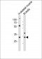 (Mouse) Mlf1 Antibody (Center)