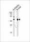 (Mouse) Ihh Antibody (C-term)