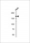 Smarcc1 Antibody (C-term)