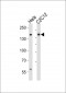 (Mouse) Smarcc1 Antibody (C-term)