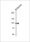 Mouse Rps6ka5 Antibody (C-term)