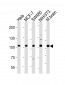 EPHA4 Antibody (Center)