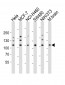 EPHA4 Antibody (Center)