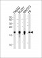 Mouse Hmga2 Antibody (C-term)