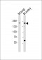 Mouse Erbb2 Antibody (P1142)