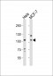 EPHA4 Antibody (Center)