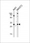 CDK5 Antibody (C-term)