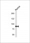 SYK Antibody (C-term)