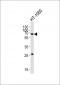 SMAD1 Antibody (Center)