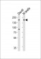 FLT3 Antibody (Center)