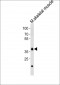 Mouse Dbx1 Antibody (C-term)