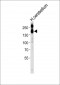 NCAM1 Antibody (C-term)