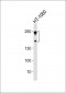 NCAM1 Antibody (C-term)