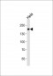 TYK2 Antibody (C-term)