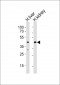 POU5F1B Antibody (C-term)