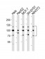 FGFR1 Antibody (Center)