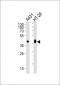 EPCAM Antibody (C-term)