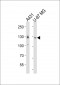 EPHA2 Antibody (Center)