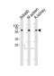 PPP2R1B Antibody (N-term)