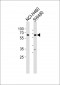 PPP2R1B Antibody (N-term)