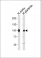 ENG Antibody (C-term)