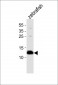 (DANRE) ba1 Antibody (N-term)